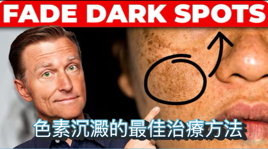 如何去除色素沉著