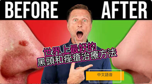 世界上最好的黑頭和痤瘡治療方法（一次性解決）